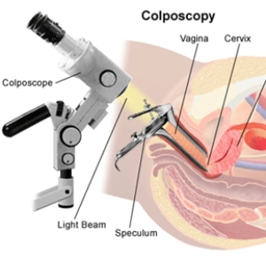 kolposkopiya.jpg