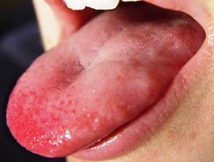 answer.jpeg answer.jpeg