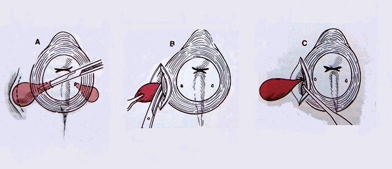 anal gland.jpg