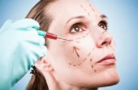 vampire facelift.jpg