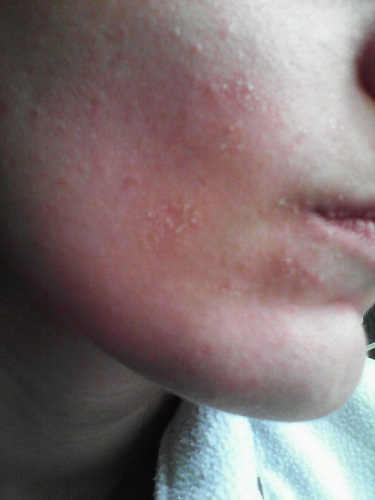 IMG_20160609_113849.jpg IMG_20160609_113849.jpg