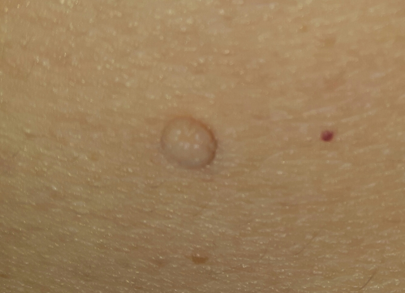 20170818_140338.jpg 20170818_140338.jpg