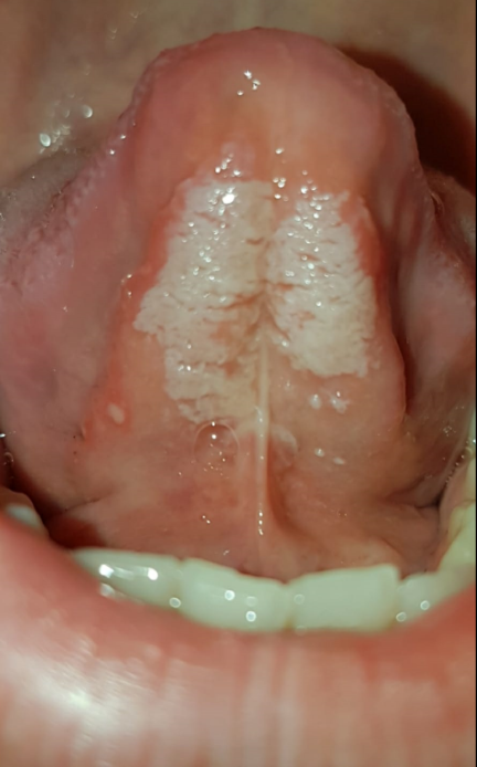 снимка.PNG снимка.PNG