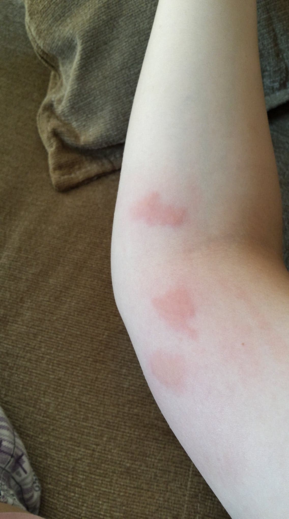 тези са текущите на ръката ми / 38270433_1089171171220967_1856368982265692160_n.jpg 38270433_1089171171220967_1856368982265692160_n.jpg