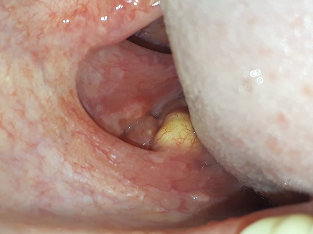 IMG_20190426_082500.jpg IMG_20190426_082500.jpg