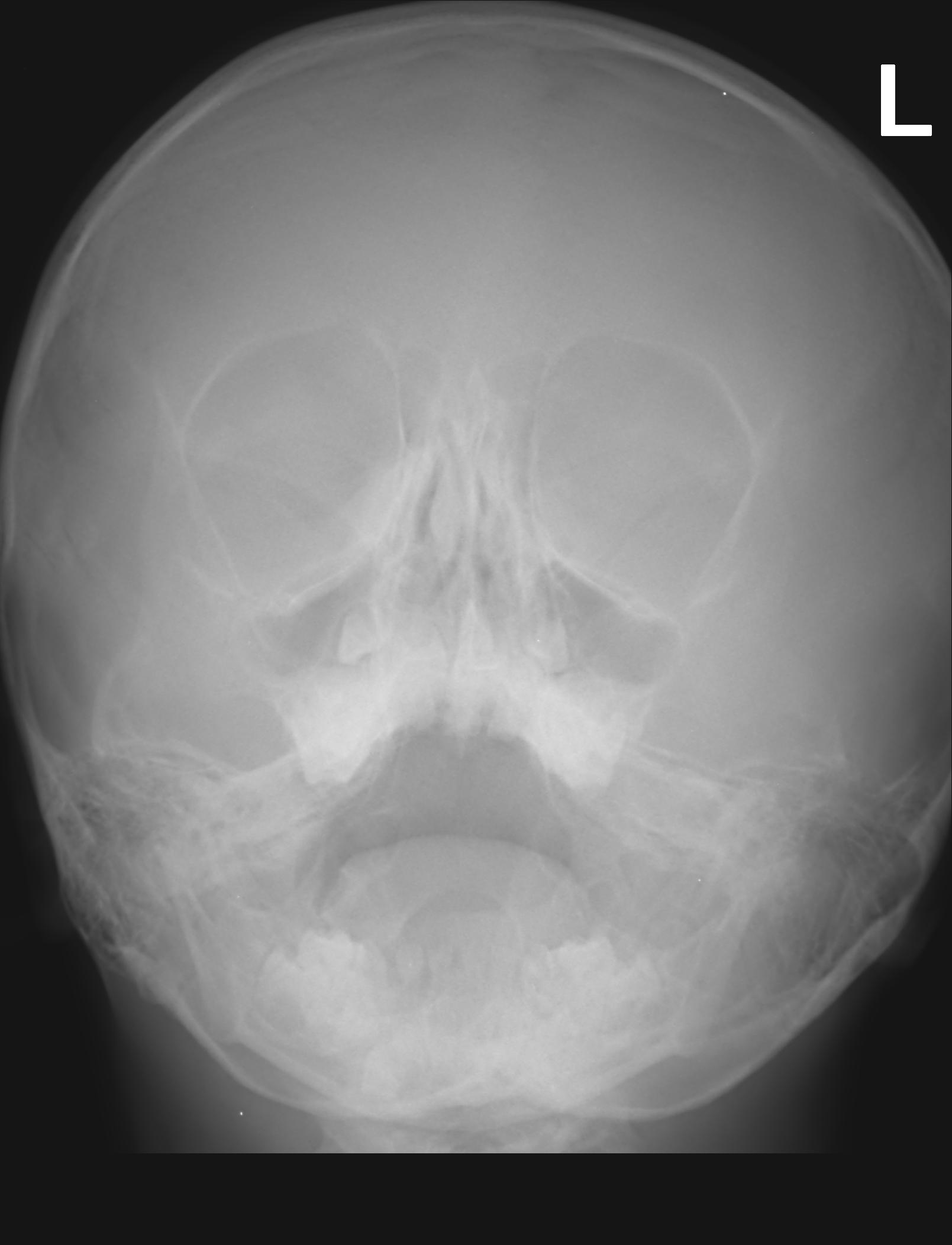 След лечението / IS01_001_3.jpg IS01_001_3.jpg