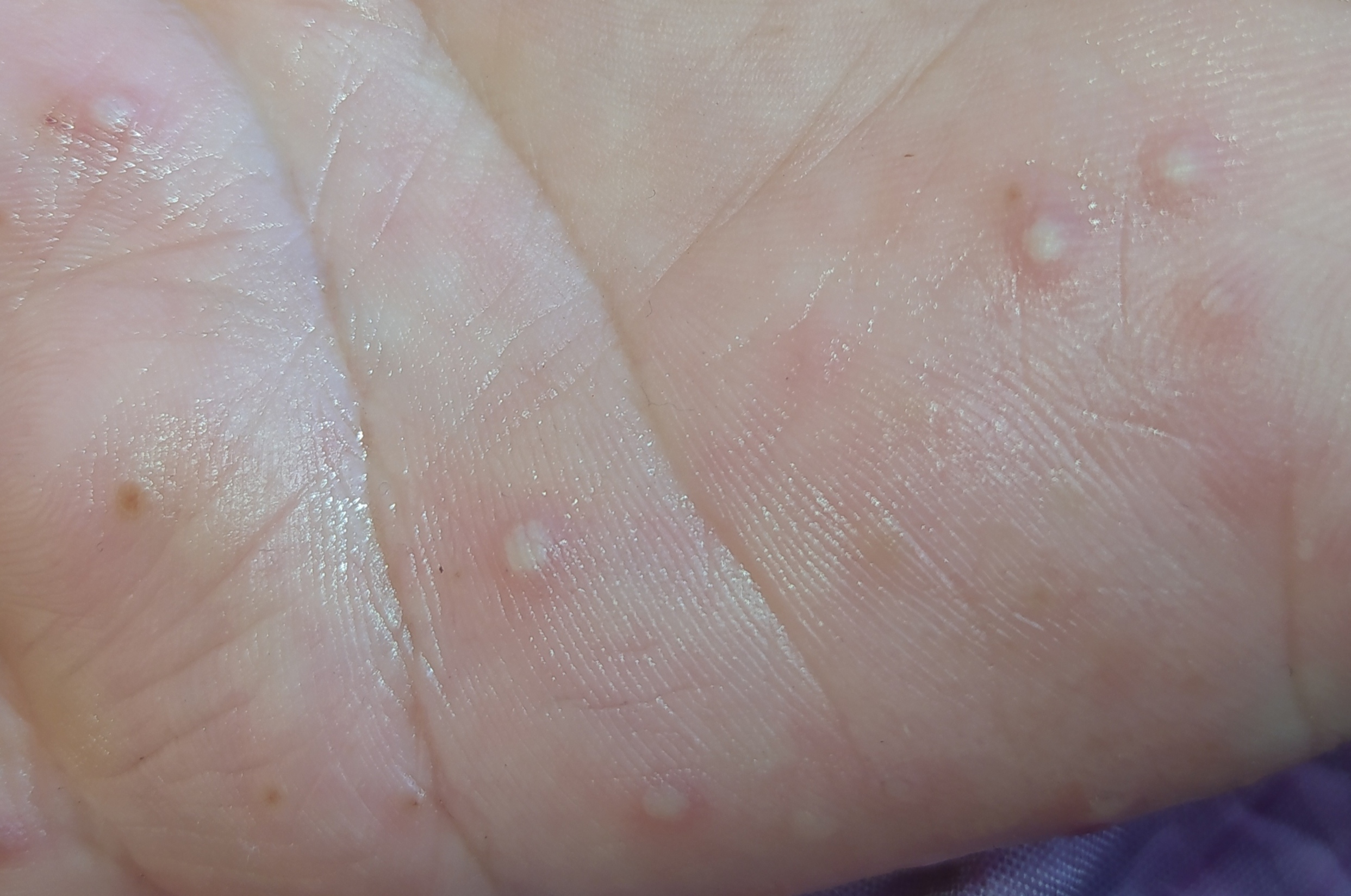 IMG_20200524_111638.jpg IMG_20200524_111638.jpg